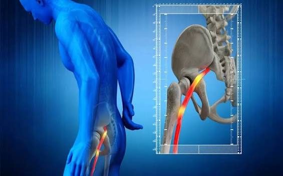 Hình minh hoạ đường đi của dây thần kinh tọa từ vùng thắt lưng xuống chân